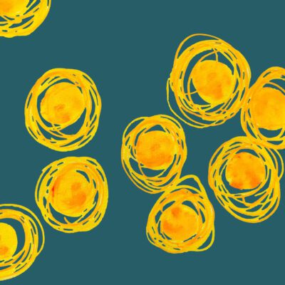 Farbenfrohes Wanddesign von Anna von der Heiden bei AN-NA Design. Hochwertiger Druck auf Leinwand. Serie Bubbles in verschiedenen Gelbtönen, auf grünem Hintergrund.